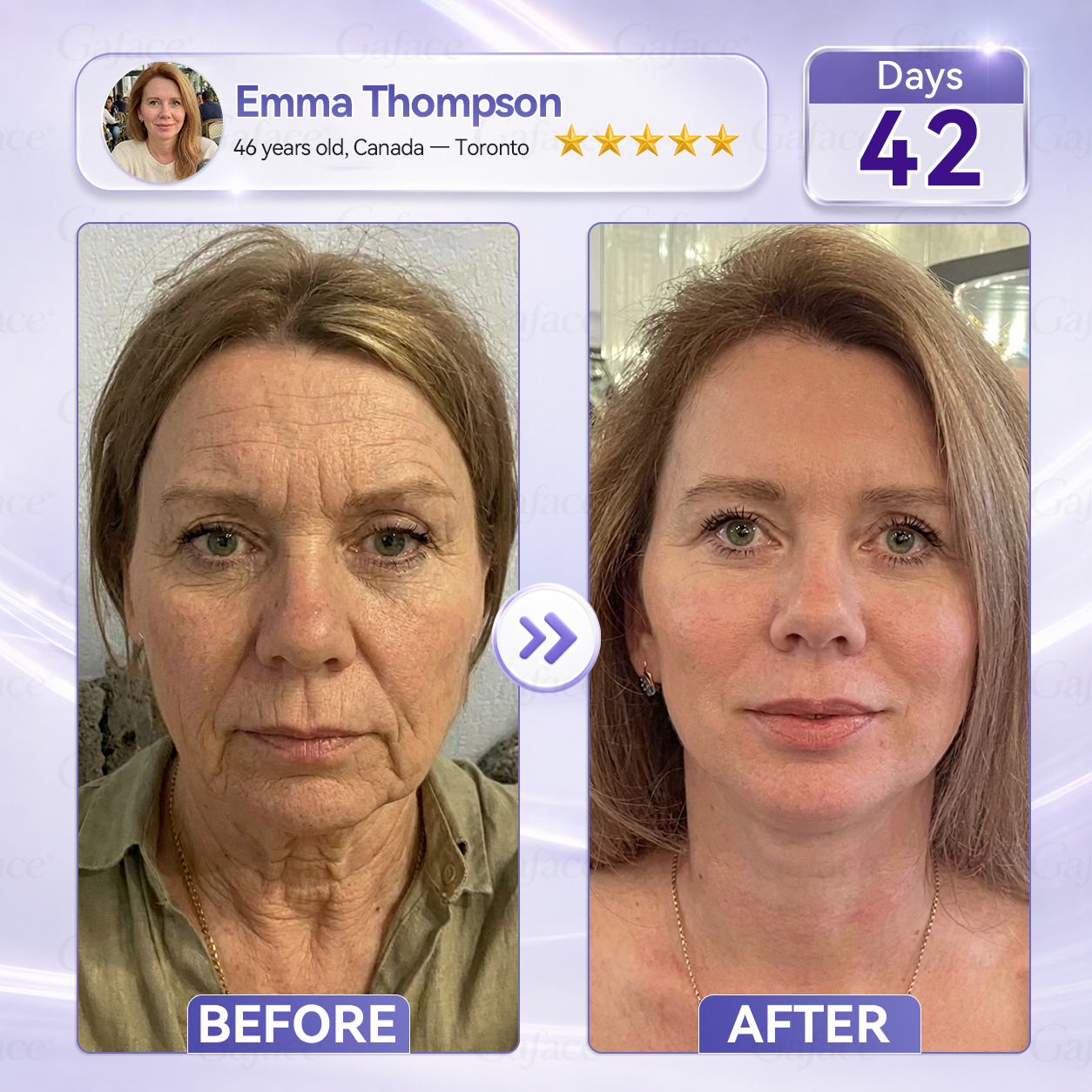 ✨🌿𝐆𝐚𝐟𝐚𝐜𝐞® 𝐂𝐨𝐥𝐥𝐚𝐠𝐞𝐧 & 𝐅𝐮𝐥𝐥𝐞𝐫𝐞𝐧𝐞 𝐑𝐨𝐥𝐥𝐞𝐫 𝐅𝐢𝐫𝐦𝐢𝐧𝐠 𝐂𝐫𝐞𝐚𝐦