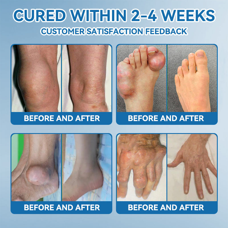 𝐎𝐟𝐟𝐢𝐜𝐢𝐚𝐥 𝐒𝐭𝐨𝐫𝐞 | 𝑷𝐢𝐜𝐝𝐨® 👩‍⚕️𝖡𝖯𝖢-157 Joint Healing Cream🦴Treats Arthritis, Neuropathy, Rheumatism, Sports Injuries & More