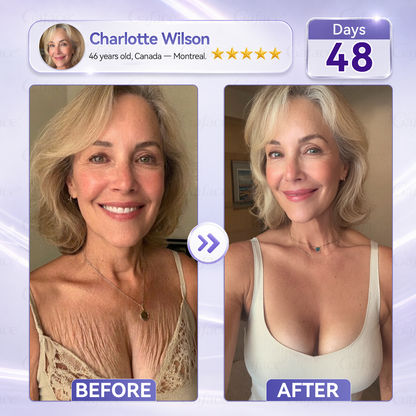 ✨🌿𝐆𝐚𝐟𝐚𝐜𝐞® 𝐂𝐨𝐥𝐥𝐚𝐠𝐞𝐧 & 𝐅𝐮𝐥𝐥𝐞𝐫𝐞𝐧𝐞 𝐑𝐨𝐥𝐥𝐞𝐫 𝐅𝐢𝐫𝐦𝐢𝐧𝐠 𝐂𝐫𝐞𝐚𝐦