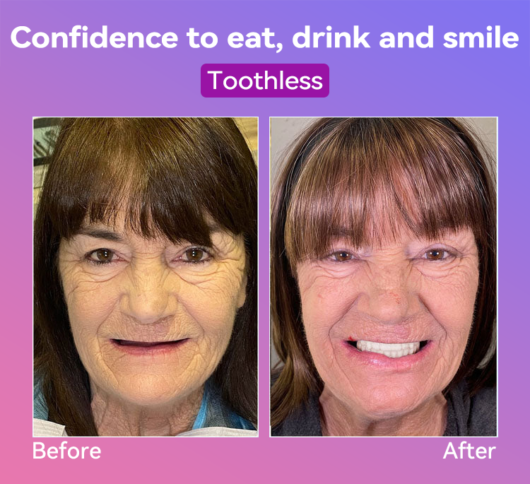 𝐉𝐚𝐬𝐬𝐞𝐞𝐦®👩‍⚕️🎁 𝐿𝑎𝑡𝑒𝑠𝑡 𝑃𝑟𝑒𝑚𝑖𝑢𝑚 𝐶𝑜𝑚𝑓𝑜𝑟𝑡 𝐷𝑒𝑛𝑡𝑢𝑟𝑒𝑠  (𝐻𝑖𝑔ℎ-𝐸𝑛𝑑 𝐷𝑒𝑛𝑡𝑢𝑟𝑒𝑠, 𝐸𝑎𝑠𝑦 𝑡𝑜 𝑊𝑒𝑎𝑟 - 𝐿𝑖𝑚𝑖𝑡𝑒𝑑 𝑇𝑖𝑚𝑒 70% 𝐷𝑖𝑠𝑐𝑜𝑢𝑛𝑡)