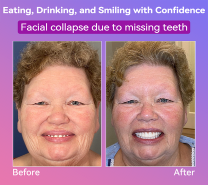 𝐉𝐚𝐬𝐬𝐞𝐞𝐦®👩‍⚕️🎁 𝐿𝑎𝑡𝑒𝑠𝑡 𝑃𝑟𝑒𝑚𝑖𝑢𝑚 𝐶𝑜𝑚𝑓𝑜𝑟𝑡 𝐷𝑒𝑛𝑡𝑢𝑟𝑒𝑠  (𝐻𝑖𝑔ℎ-𝐸𝑛𝑑 𝐷𝑒𝑛𝑡𝑢𝑟𝑒𝑠, 𝐸𝑎𝑠𝑦 𝑡𝑜 𝑊𝑒𝑎𝑟 - 𝐿𝑖𝑚𝑖𝑡𝑒𝑑 𝑇𝑖𝑚𝑒 70% 𝐷𝑖𝑠𝑐𝑜𝑢𝑛𝑡)