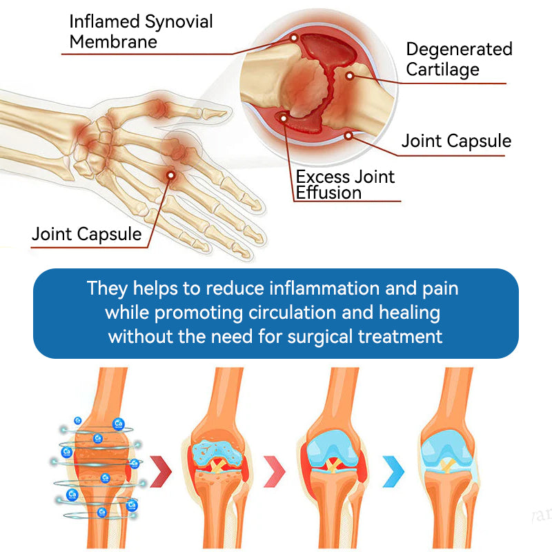 𝐎𝐟𝐟𝐢𝐜𝐢𝐚𝐥 𝐒𝐭𝐨𝐫𝐞 | 𝑷𝐢𝐜𝐝𝐨® 👩‍⚕️𝖡𝖯𝖢-157 Joint Healing Cream🦴Treats Arthritis, Neuropathy, Rheumatism, Sports Injuries & More