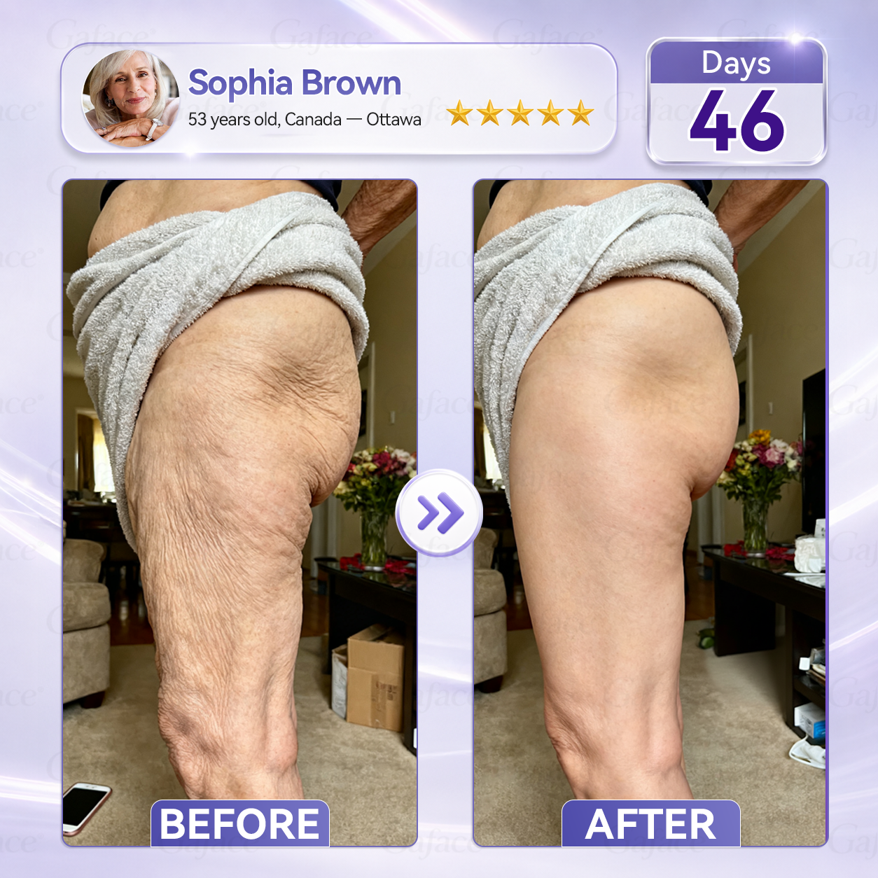 ✨🌿𝐆𝐚𝐟𝐚𝐜𝐞® 𝐂𝐨𝐥𝐥𝐚𝐠𝐞𝐧 & 𝐅𝐮𝐥𝐥𝐞𝐫𝐞𝐧𝐞 𝐑𝐨𝐥𝐥𝐞𝐫 𝐅𝐢𝐫𝐦𝐢𝐧𝐠 𝐂𝐫𝐞𝐚𝐦
