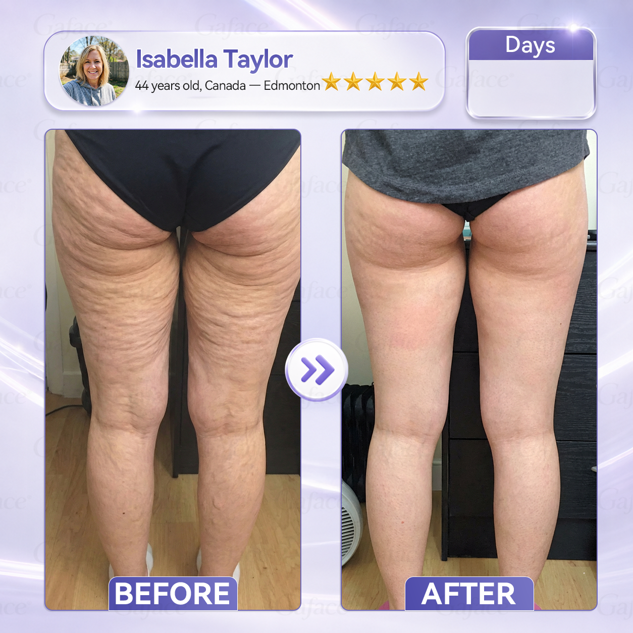 ✨🌿𝐆𝐚𝐟𝐚𝐜𝐞® 𝐂𝐨𝐥𝐥𝐚𝐠𝐞𝐧 & 𝐅𝐮𝐥𝐥𝐞𝐫𝐞𝐧𝐞 𝐑𝐨𝐥𝐥𝐞𝐫 𝐅𝐢𝐫𝐦𝐢𝐧𝐠 𝐂𝐫𝐞𝐚𝐦