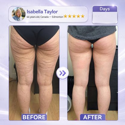 ✨🌿𝐆𝐚𝐟𝐚𝐜𝐞® 𝐂𝐨𝐥𝐥𝐚𝐠𝐞𝐧 & 𝐅𝐮𝐥𝐥𝐞𝐫𝐞𝐧𝐞 𝐑𝐨𝐥𝐥𝐞𝐫 𝐅𝐢𝐫𝐦𝐢𝐧𝐠 𝐂𝐫𝐞𝐚𝐦