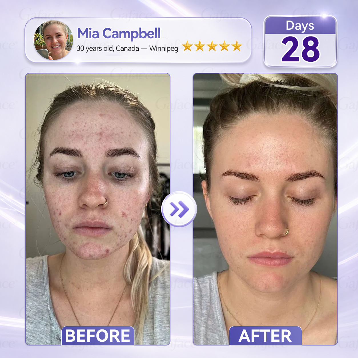 ✨🌿𝐆𝐚𝐟𝐚𝐜𝐞® 𝐂𝐨𝐥𝐥𝐚𝐠𝐞𝐧 & 𝐅𝐮𝐥𝐥𝐞𝐫𝐞𝐧𝐞 𝐑𝐨𝐥𝐥𝐞𝐫 𝐅𝐢𝐫𝐦𝐢𝐧𝐠 𝐂𝐫𝐞𝐚𝐦