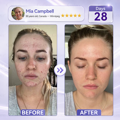 ✨🌿𝐆𝐚𝐟𝐚𝐜𝐞® 𝐂𝐨𝐥𝐥𝐚𝐠𝐞𝐧 & 𝐅𝐮𝐥𝐥𝐞𝐫𝐞𝐧𝐞 𝐑𝐨𝐥𝐥𝐞𝐫 𝐅𝐢𝐫𝐦𝐢𝐧𝐠 𝐂𝐫𝐞𝐚𝐦