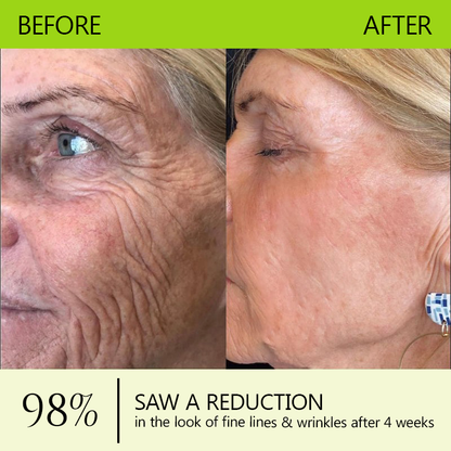 Regain youthful skin nown 💖STDEI® BOTOX & VITA A RETINOL SHOT Wrinkle Lift Tightening Cream