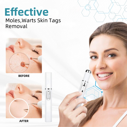 𝐉𝐚𝐬𝐬𝐞𝐞𝐦® Medical-Grade Laser Pen 🌏 (Powered by CO₂ laser technology – effectively removes moles, warts, skin tags, pigmentation spots, and other skin imperfections)