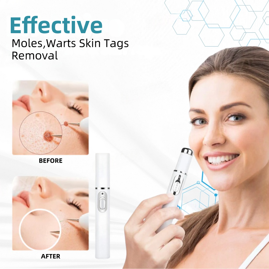 𝐉𝐚𝐬𝐬𝐞𝐞𝐦® Medical-Grade Laser Pen 🚚 (Powered by CO₂ laser technology – effectively removes moles, warts, skin tags, pigmentation spots, and other skin imperfections)