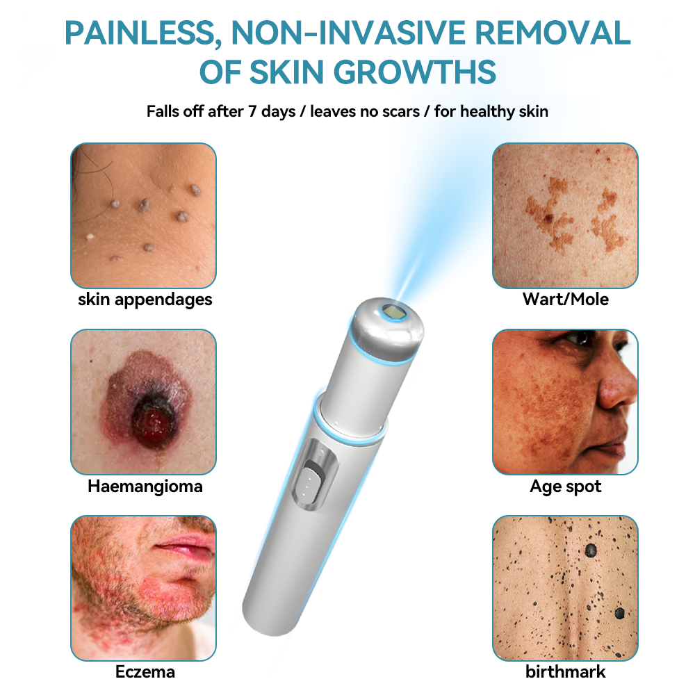 𝐉𝐚𝐬𝐬𝐞𝐞𝐦® Medical-Grade Laser Pen 🌏 (Powered by CO₂ laser technology – effectively removes moles, warts, skin tags, pigmentation spots, and other skin imperfections)