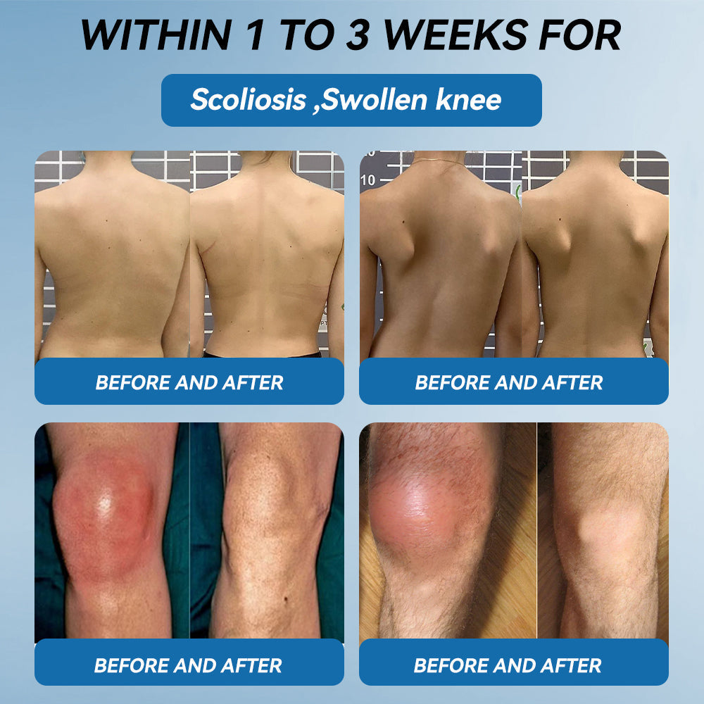 𝐎𝐟𝐟𝐢𝐜𝐢𝐚𝐥 𝐒𝐭𝐨𝐫𝐞 | 𝑷𝐢𝐜𝐝𝐨® 👩‍⚕️𝖡𝖯𝖢-157 Joint Healing Cream🦴Treats Arthritis, Neuropathy, Rheumatism, Sports Injuries & More