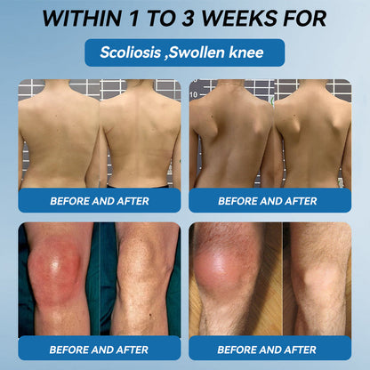𝐎𝐟𝐟𝐢𝐜𝐢𝐚𝐥 𝐒𝐭𝐨𝐫𝐞 | 𝑷𝐢𝐜𝐝𝐨® 👩‍⚕️𝖡𝖯𝖢-157 Joint Healing Cream🦴Treats Arthritis, Neuropathy, Rheumatism, Sports Injuries & More