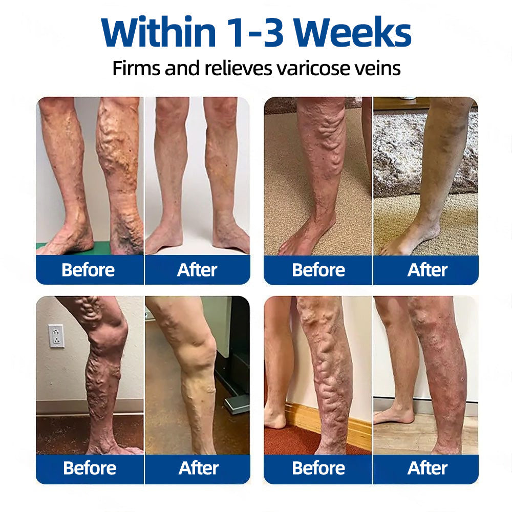 👩‍⚕️🎁 𝐅𝐥𝐨𝐫𝐢𝐬𝐦𝐚®✅𝐕𝐞𝐢𝐧𝐓𝐚𝐫𝐠𝐞𝐭 𝐌𝐢𝐜𝐫𝐨𝐧𝐞𝐞𝐝𝐥𝐞 𝐏𝐚𝐭𝐜𝐡⚡Instant Relief, Long-Term Results