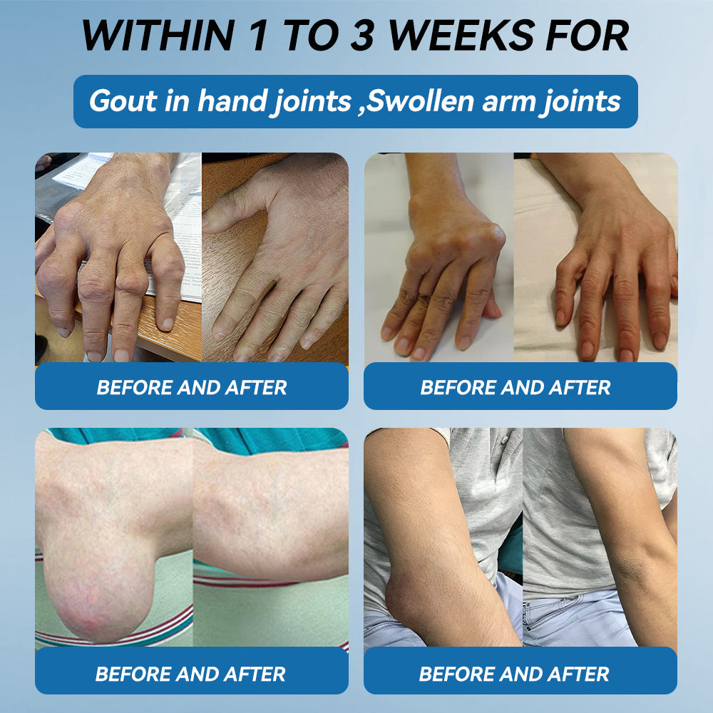 𝐎𝐟𝐟𝐢𝐜𝐢𝐚𝐥 𝐒𝐭𝐨𝐫𝐞 | 𝑷𝐢𝐜𝐝𝐨® 👩‍⚕️𝖡𝖯𝖢-157 Joint Healing Cream🦴Treats Arthritis, Neuropathy, Rheumatism, Sports Injuries & More