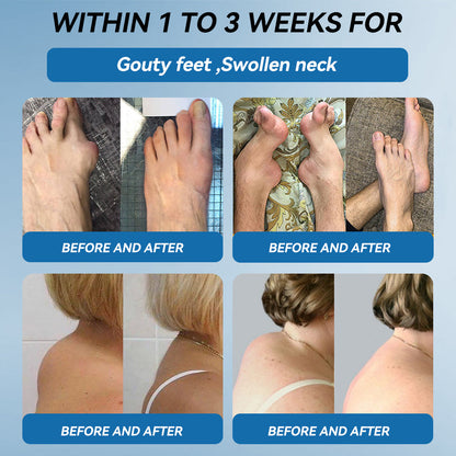 𝐎𝐟𝐟𝐢𝐜𝐢𝐚𝐥 𝐒𝐭𝐨𝐫𝐞 | 𝑷𝐢𝐜𝐝𝐨® 👩‍⚕️𝖡𝖯𝖢-157 Joint Healing Cream🦴Treats Arthritis, Neuropathy, Rheumatism, Sports Injuries & More