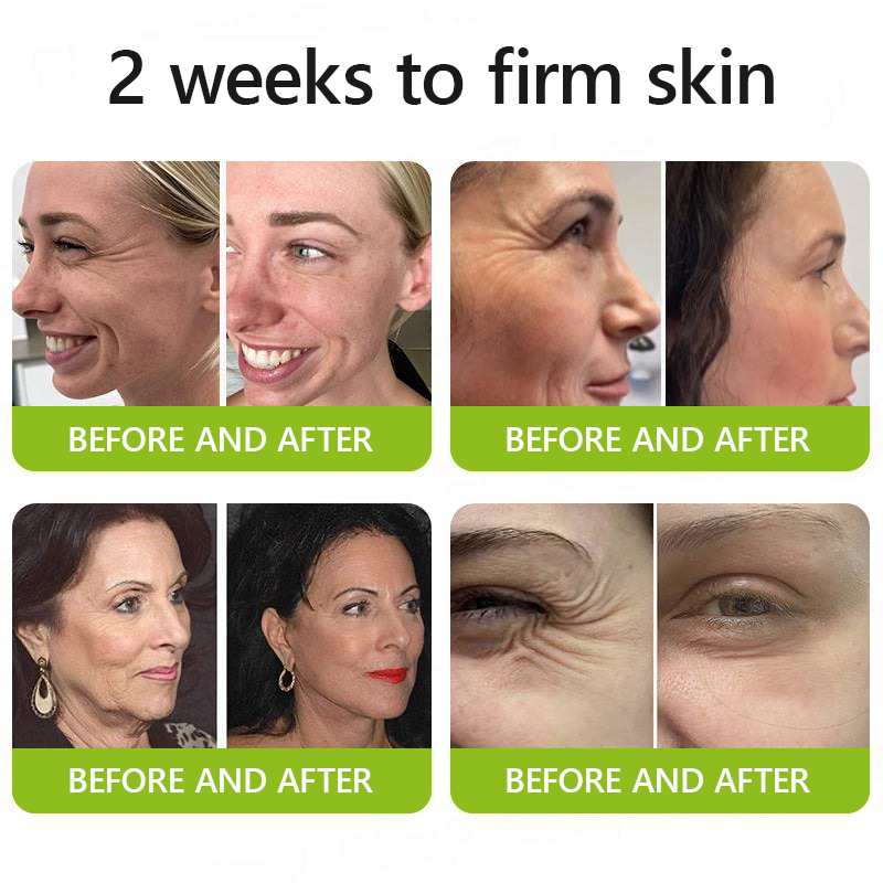 Regain youthful skin nown 💖STDEI® BOTOX & VITA A RETINOL SHOT Wrinkle Lift Tightening Cream