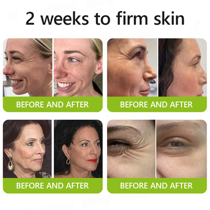 Regain youthful skin nown 💖STDEI® BOTOX & VITA A RETINOL SHOT Wrinkle Lift Tightening Cream