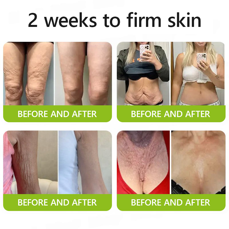 Regain youthful skin nown 💖STDEI® BOTOX & VITA A RETINOL SHOT Wrinkle Lift Tightening Cream