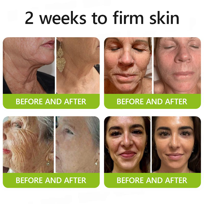 Regain youthful skin nown 💖STDEI® BOTOX & VITA A RETINOL SHOT Wrinkle Lift Tightening Cream