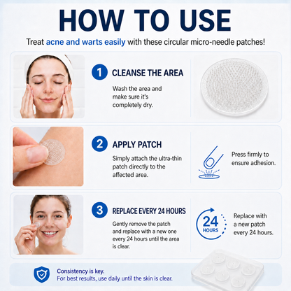 👩‍⚕️🥇 𝐎𝐟𝐟𝐢𝐜𝐢𝐚𝐥 𝐒𝐭𝐨𝐫𝐞 | 𝑵𝐞𝒌𝐢𝐬𝐬® 🌿 𝐁𝐨𝐭𝐚𝐧𝐢𝐜𝐚𝐥 𝐌𝐢𝐜𝐫𝐨𝐧𝐞𝐞𝐝𝐥𝐞 𝐇𝐲𝐝𝐫𝐨𝐜𝐨𝐥𝐥𝐨𝐢𝐝 𝐏𝐚𝐭𝐜𝐡 (𝐅𝐨𝐫 𝐒𝐤𝐢𝐧 𝐓𝐚𝐠𝐬, 𝐒𝐦𝐚𝐥𝐥 𝐒𝐤𝐢𝐧 𝐆𝐫𝐨𝐰𝐭𝐡𝐬, 𝐖𝐚𝐫𝐭𝐬, 𝐌𝐨𝐥𝐞𝐬, 𝐀𝐠𝐞 𝐒𝐩𝐨𝐭𝐬 & 𝐏𝐢𝐠𝐦𝐞𝐧𝐭𝐚𝐭𝐢𝐨𝐧 𝐂𝐨𝐧𝐜𝐞𝐫𝐧𝐬)
